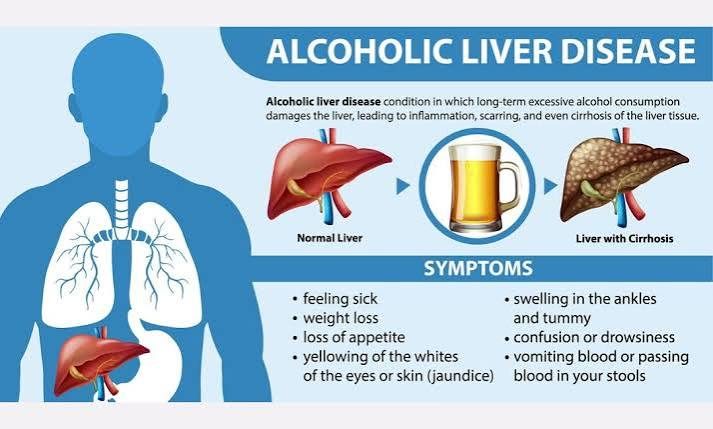 What actually happens to your liver after night of heavy drinking?