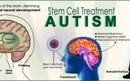 SC bars stem cell therapy for autism outside clinical trials
