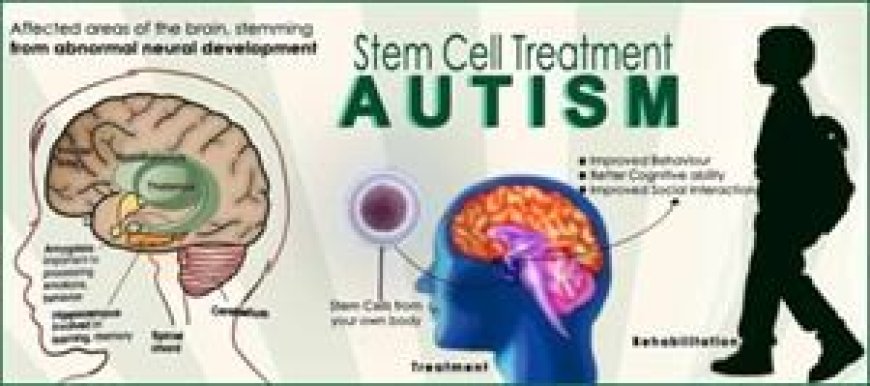 SC bars stem cell therapy for autism outside clinical trials
