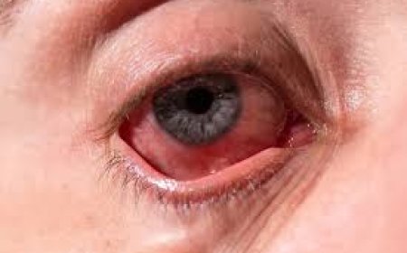 Red, Dry, Or Puffy Eyes? Experts Explain What’s Normal And What’s Not