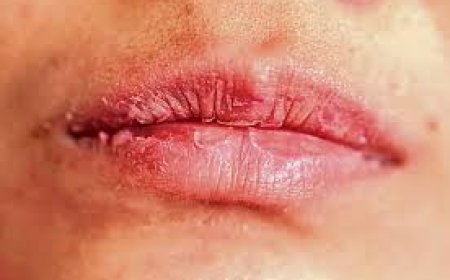 Conditioning Lips Through Cold Weather