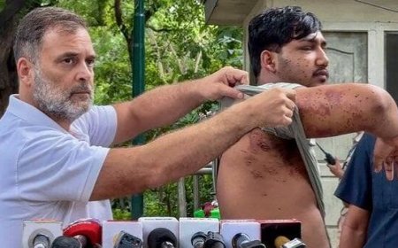 Ex-IPS officer, injured protesters move SC against pellet guns