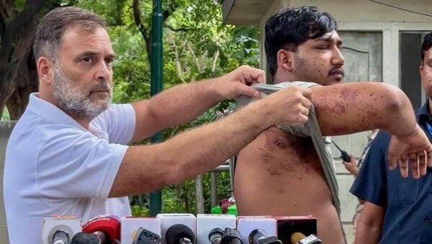 Ex-IPS officer, injured protesters move SC against pellet guns