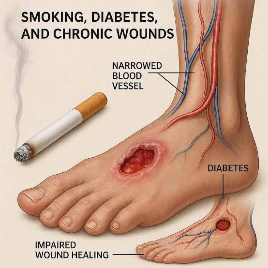 Tobacco & diabetes increase amputation risk 